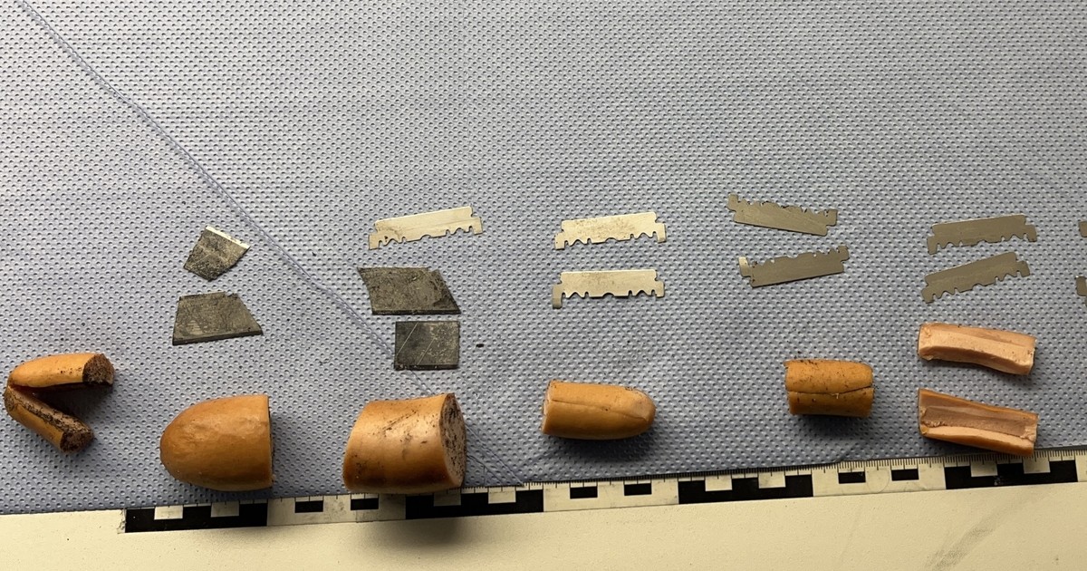 Wurst-mit-Rasierklingen-in-Schwandorf-ausgelegt